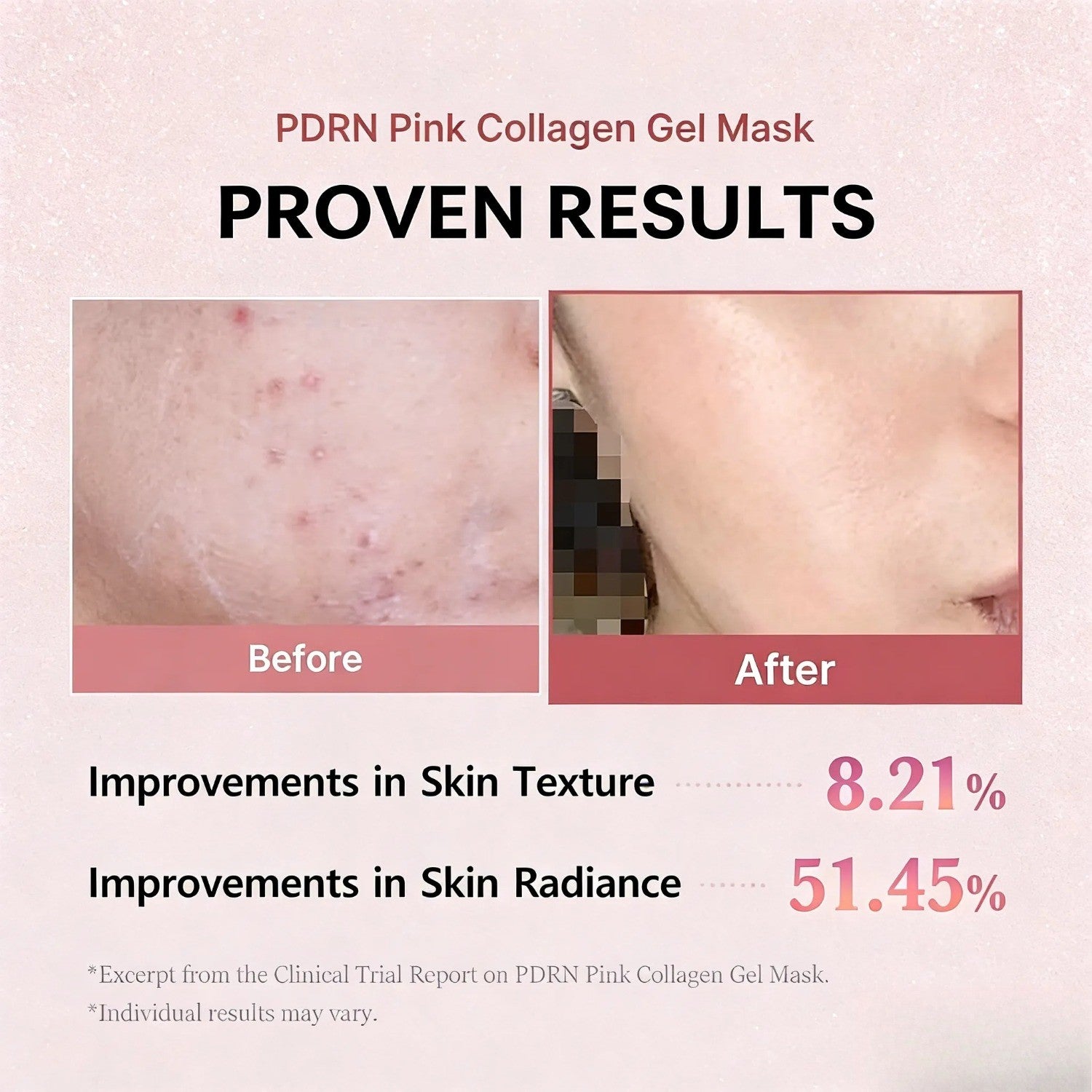 Salmon PDRN Pink Collagen Mask.Anti-Agin